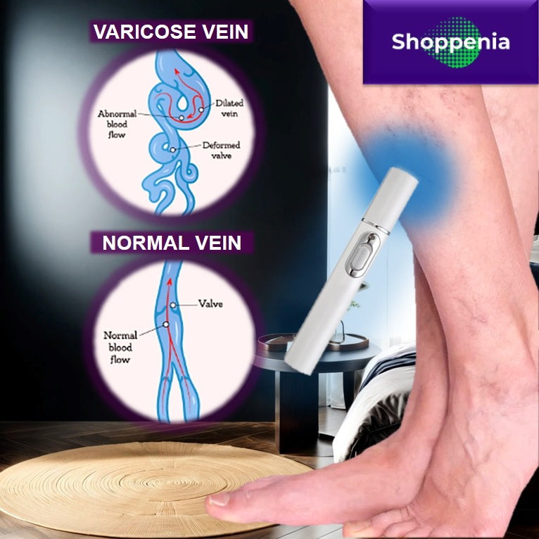 Varicose vein relief device main